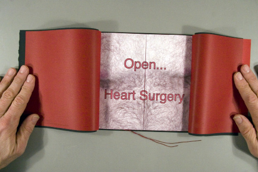 peven.Open...Heart%20Surgery.1.jpg